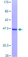 Human CFL1 / Cofilin Protein (Recombinant GST)