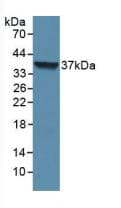 Loricrin Antibody (aa210-295)