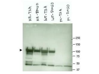 IHC-plus™ HSP90AA1 / Hsp90 Alpha A1 Antibody