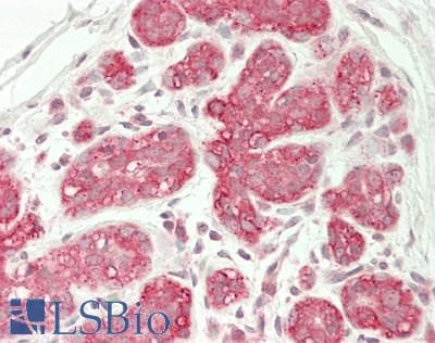 IHC-plus™ ALPL / Alkaline Phosphatase Antibody (aa 28-501)