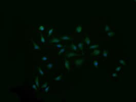 SYP / Synaptophysin Antibody (clone OTI1A1)