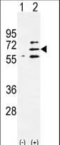 Polyclonal Rabbit anti-Human PARP6 Antibody (aa508-538, WB)