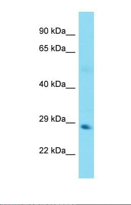 TANK Antibody (aa48-97)