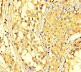 Polyclonal Rabbit anti-Human RNF20 Antibody (IHC)