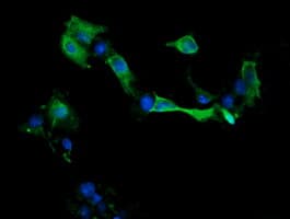 MAP2K1 / MKK1 / MEK1 Antibody (clone OTI2B2, Carrier-free)