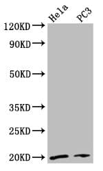 NDUFAF2 / NDUFA12L Antibody