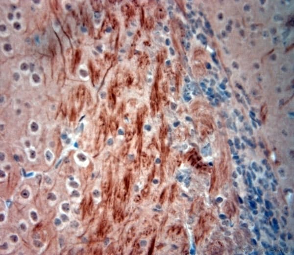 NEFH / NF-H Antibody (aa150-200)