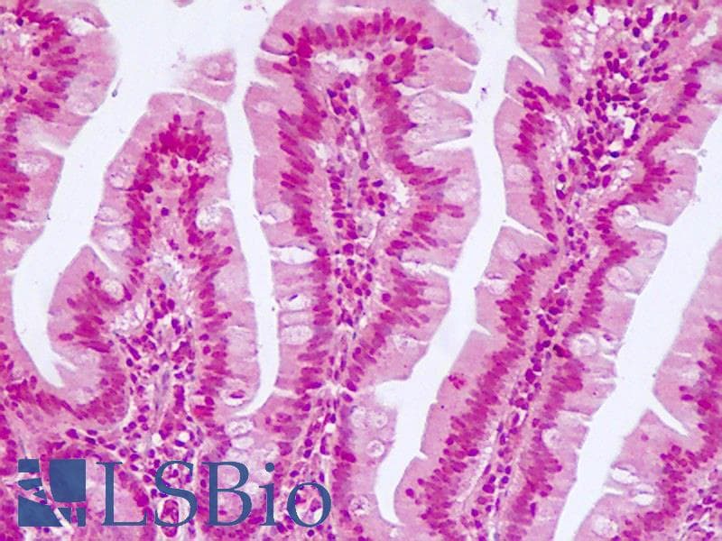 IHC-plus™ TCF7L2 / TCG4 Antibody (N-Terminus)