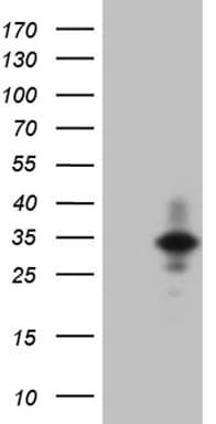 IL24 Antibody (aa52-206, clone OTI5C8)