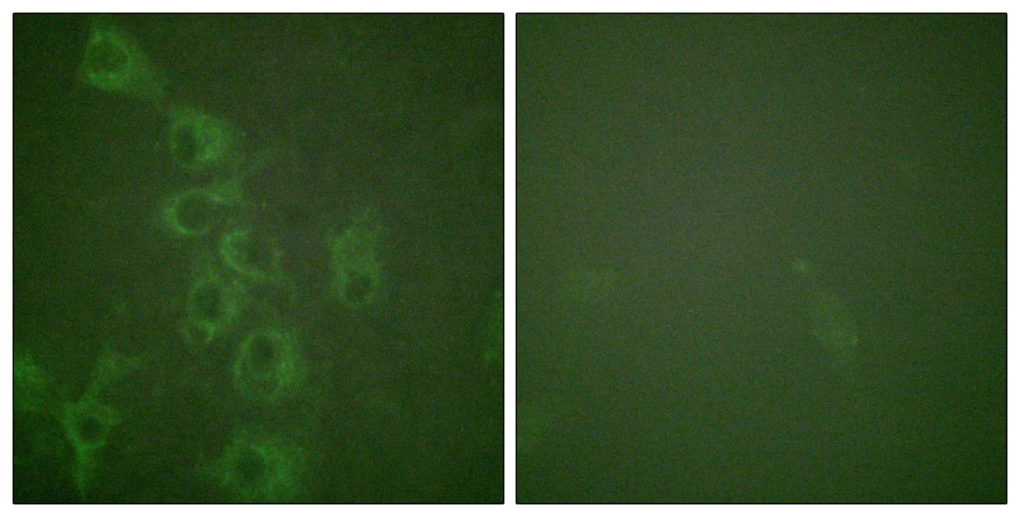 Polyclonal Rabbit anti-Human HRH1 / Histamine H1 Receptor Antibody (phospho-Ser398, IF)