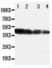 Delta3 / DLL3 Antibody (aa599-618)
