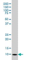 PathPlus™ S100A6 / Calcyclin Antibody (clone 6B5)