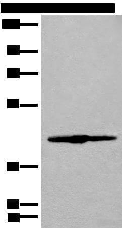 Polyclonal Rabbit anti-Human IVD Antibody (WB)