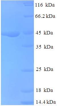 Human NDUFA6 Protein (Recombinant GST)