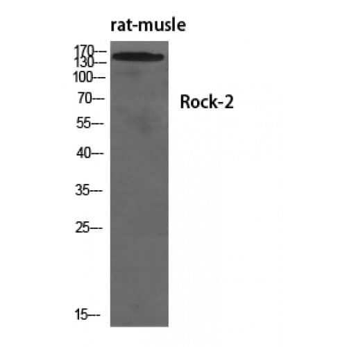 ROCK2 Antibody (660-740 aa)