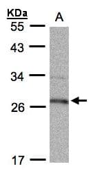 IHC-plus™ Polyclonal Rabbit anti-Human 15-PGDH / HPGD Antibody (aa205-266, IHC, WB)