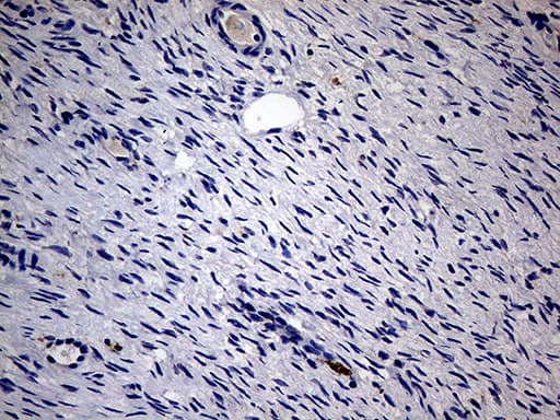 KRT18 / CK18 / Cytokeratin 18 Antibody (aa69-372, clone OTI10H8)
