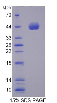 Human MS / MTR Protein (Recombinant His-T7)