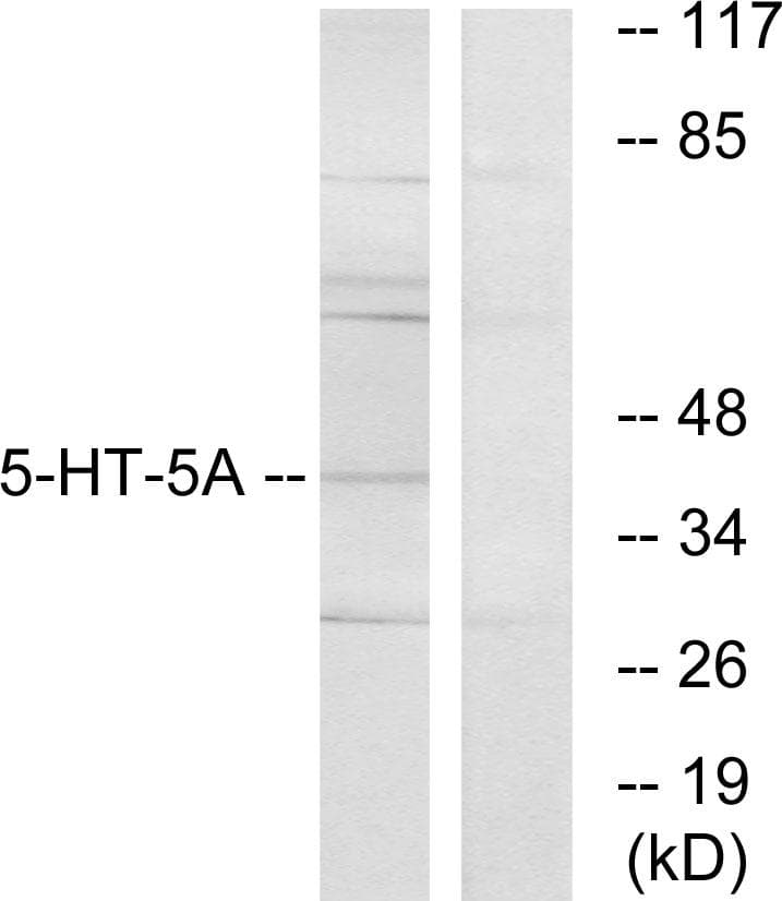 Polyclonal Rabbit anti-Human HTR5A / 5-HT5A Receptor Antibody (WB)