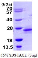 Human RHOD Protein (Recombinant His)