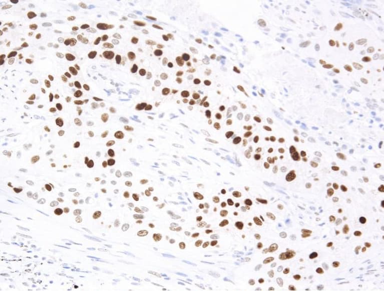 Monoclonal Mouse anti-Human TP53 / p53 Antibody (clone AHC0202, Ready-to-Use, IHC, WB)