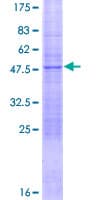 Human NAT14 Protein (Recombinant GST)