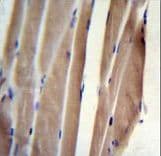 Polyclonal Rabbit anti-Human POLR2J Antibody (aa86-115, IHC, WB)