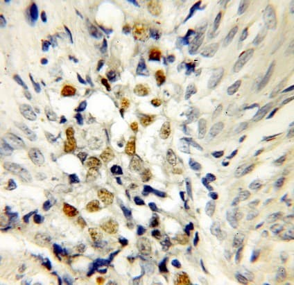 TP53 / p53 Antibody