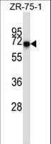 Polyclonal Rabbit anti-Human CD5 Antibody (aa203-232, IHC, WB)