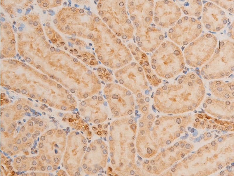 TP73 / p73 Antibody (phospho-Tyr99)
