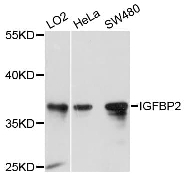 IGFBP2 / IGF-BP53 Antibody