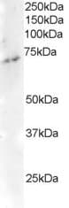 IHC-plus™ Polyclonal Goat anti-Human ELMO3 Antibody (aa760-773, IHC, WB)