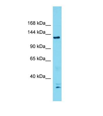 Polyclonal Rabbit anti-Human ERCC5 / XPG Antibody (aa258-307, WB)
