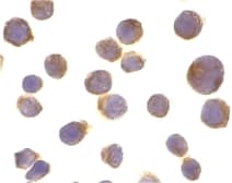 TNFRSF10A / DR4 Antibody
