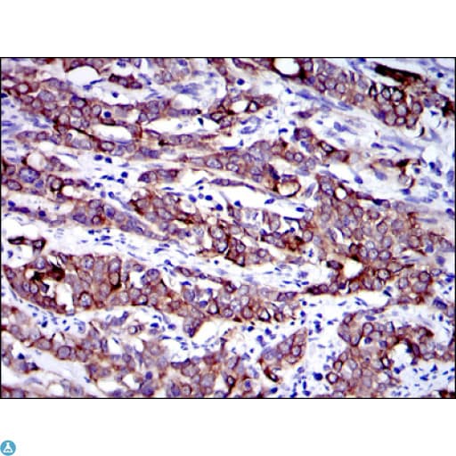KRT19 / CK19 / Cytokeratin 19 Antibody