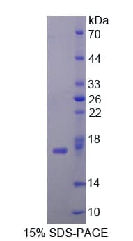 Human CDA / Cytidine Deaminase Protein (Recombinant His-T7)