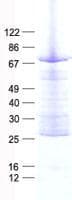 Human CRAT Protein (Recombinant His, N-Terminal)