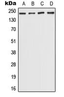 Polyclonal Rabbit anti-Human CHD5 Antibody (Internal, WB)