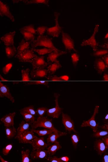 ABL1 / c-ABL Antibody (phospho-Tyr245)