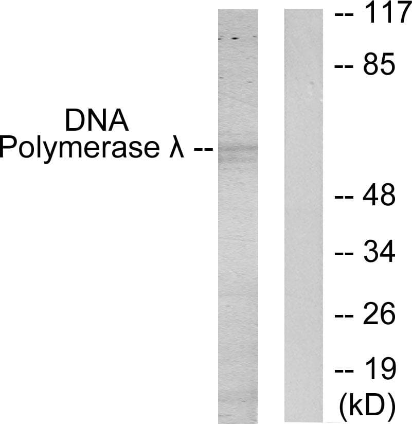 POLL / DNA Polymerase Lambda Antibody