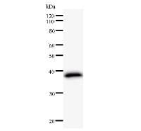 FER Antibody (clone 2358C3a)