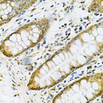 Polyclonal Rabbit anti-Human PGK1 / Phosphoglycerate Kinase Antibody (IHC, WB)