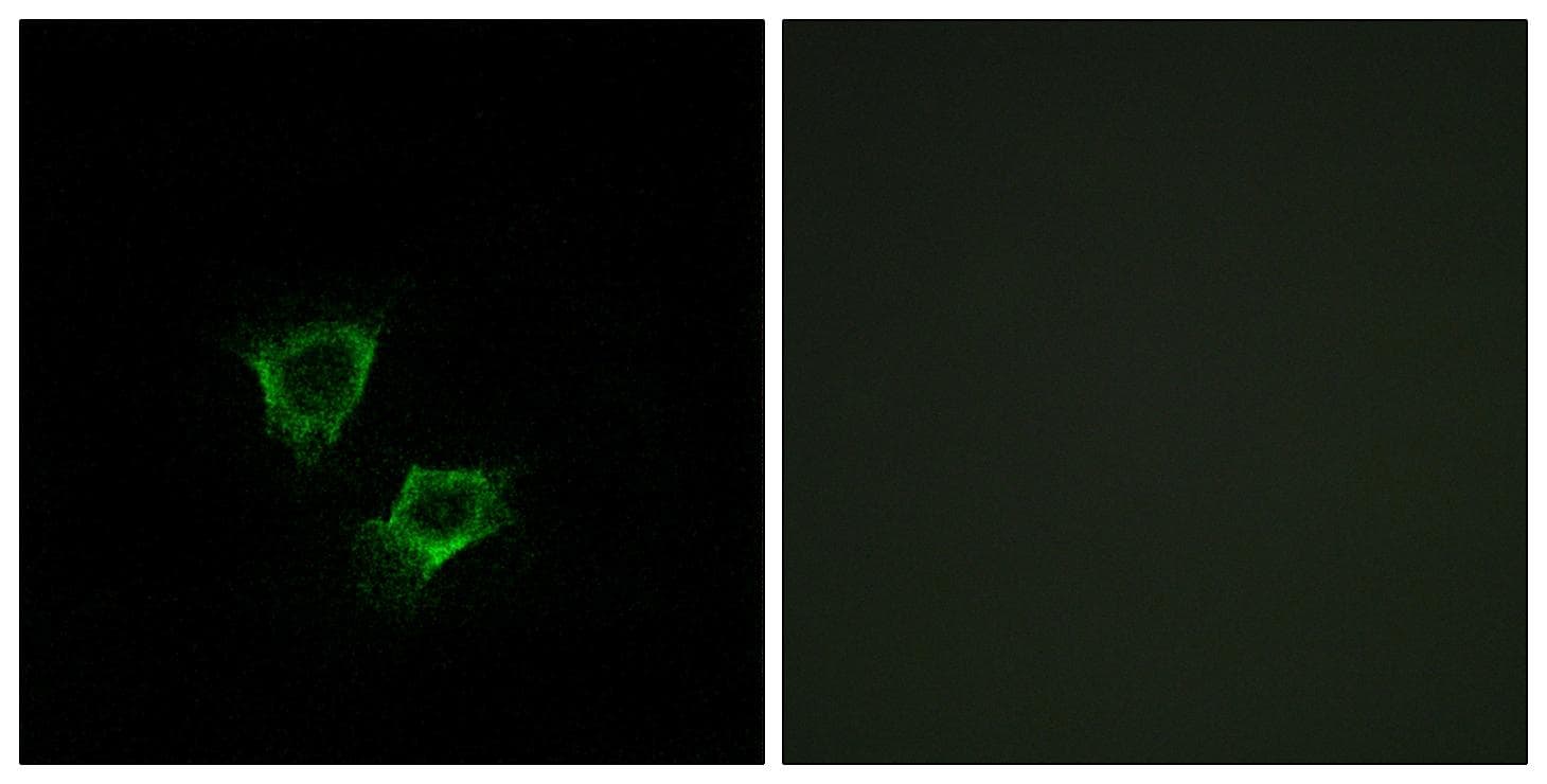 Polyclonal Rabbit anti-Human ZNRF2 Antibody (IF)