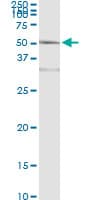 IHC-plus™ ACY1 / Aminoacylase 1 Antibody (clone 4F1-B7)