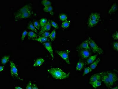 LDLR / LDL Receptor Antibody