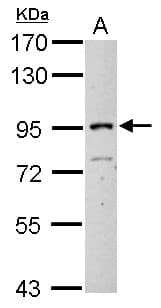 ITIH3 Antibody (aa119-383)