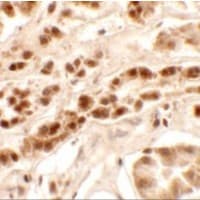 PTCHD2 Antibody