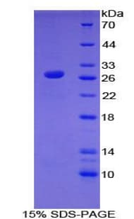 Human TLR6 Protein (Recombinant His-T7)