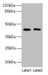Polyclonal Rabbit anti-Human BTBD6 Antibody (IHC, WB)
