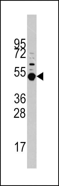 MAPKAPK5 / PRAK Antibody (Thr182)